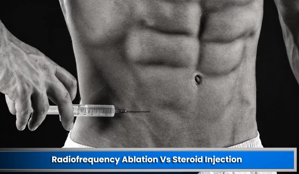 Radiofrequency Ablation Vs Steroid Injection: Which One Would Be Better for You?