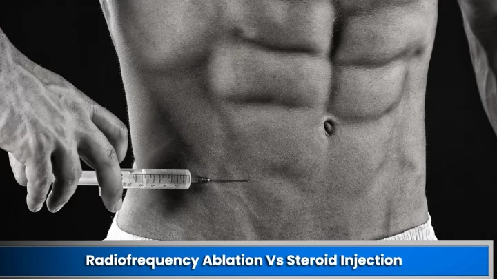 Radiofrequency Ablation Vs Steroid Injection