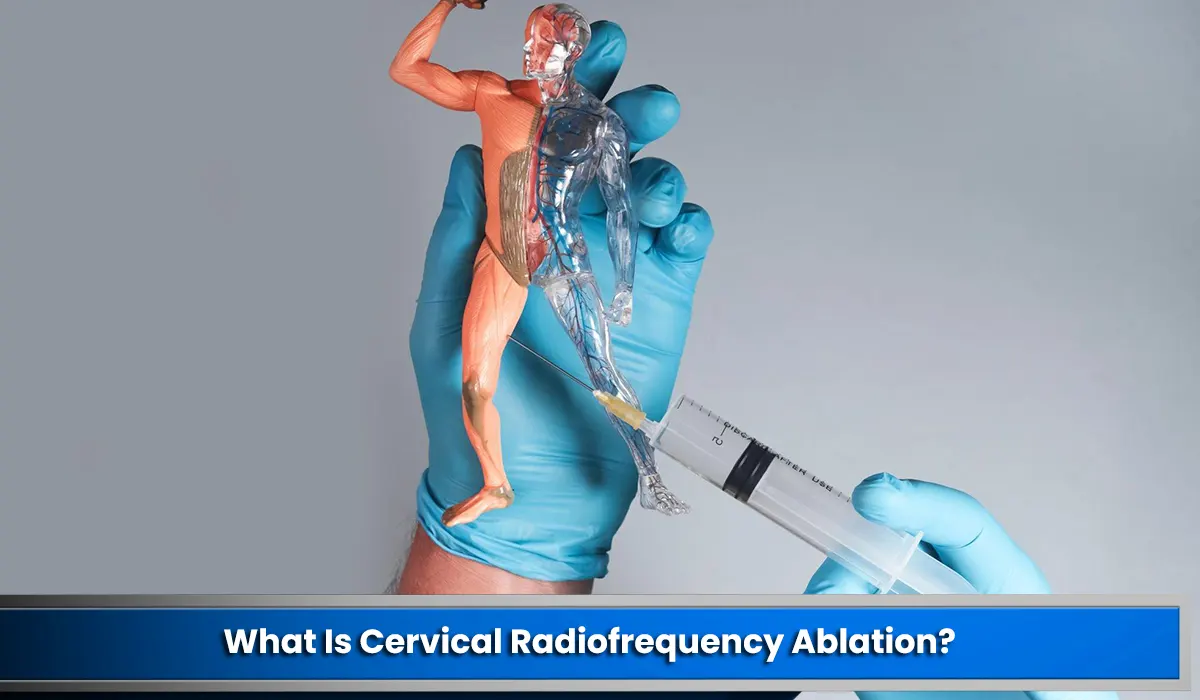 What Is Cervical Radiofrequency Ablation?
